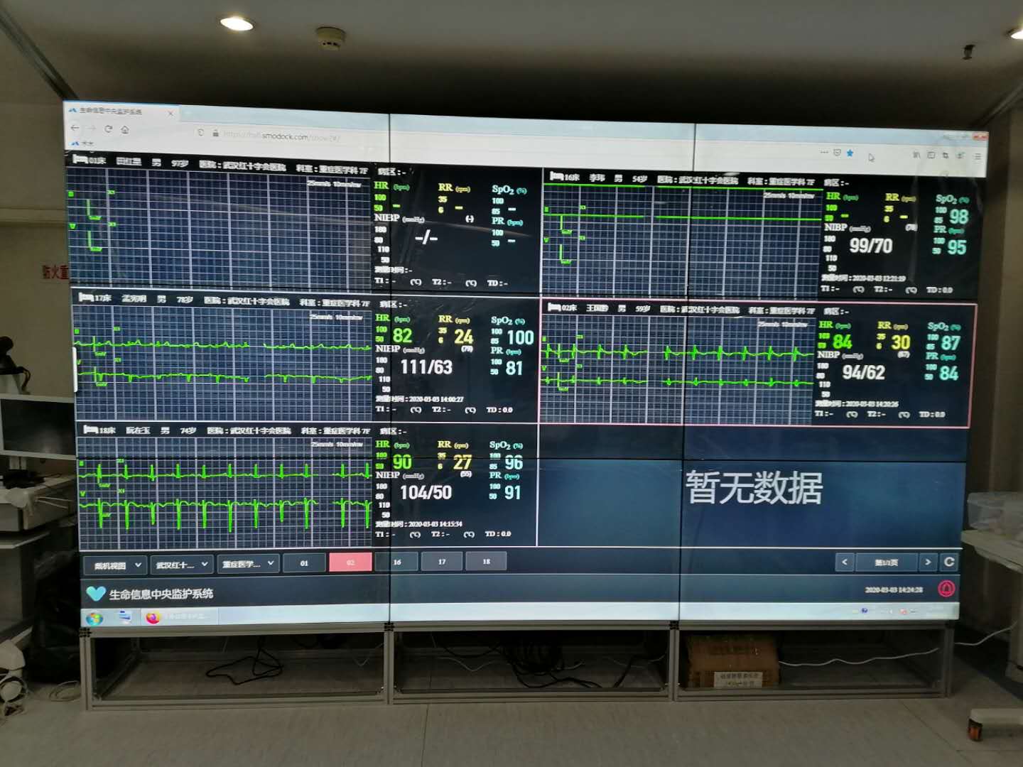 萬(wàn)衡光電拼接屏與醫(yī)療設(shè)備專題案例二